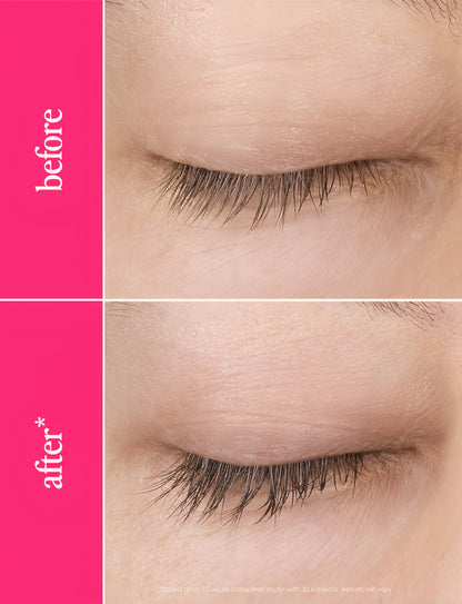 Grande Cosmetics GrandeLASH-MD Lash Enhancing Serum - Peptide & Vitamin Infused Formula for Longer, Thicker, Fuller Looking Lashes - Ophthalmologist Tested, Cruelty-Free